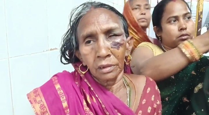 6 -year -old child and family beaten up brutally by alleging chocolate theft