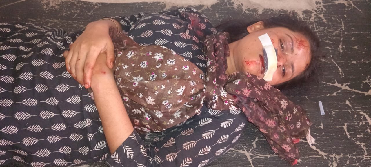 Bus and pickup collision in Kaiserganj, 20 injured, 9 conditions critical